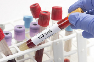 Best STD Testing Services