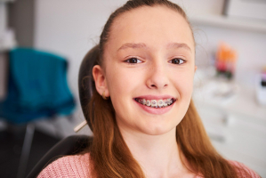 Best Places For Braces in Northern California