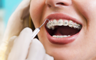 Best Places for Braces in Wyoming