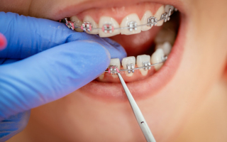 Best Places to Get Braces in New Hampshire