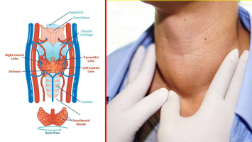 Signs and Symptoms of Thyroid Cancer
