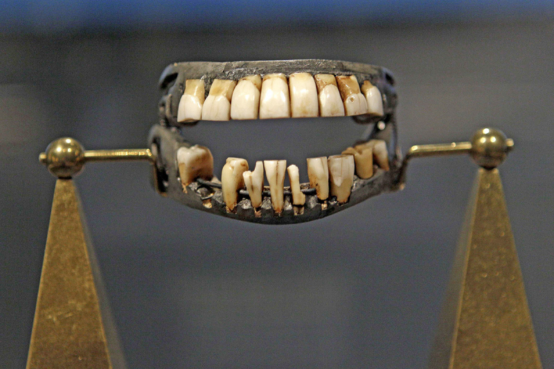 Photo: Washington's teeth - livescience