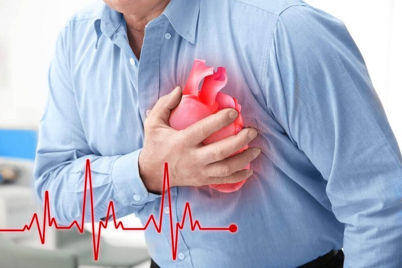 Cardiac arrhythmias