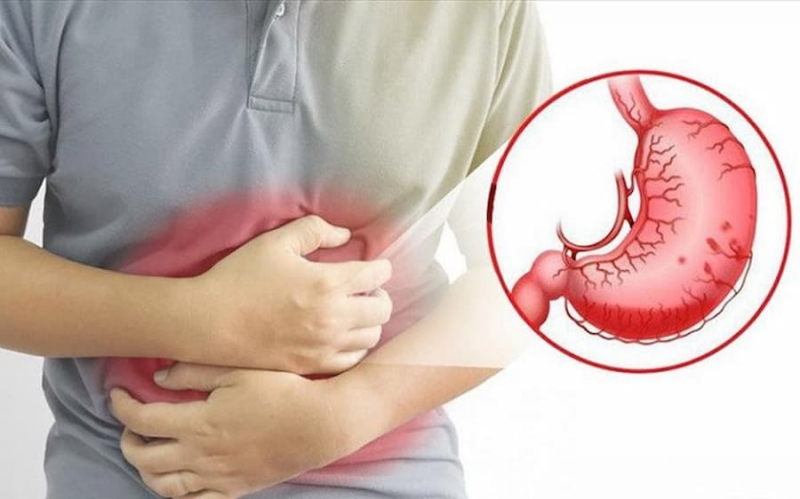 Cure stomach ulcers