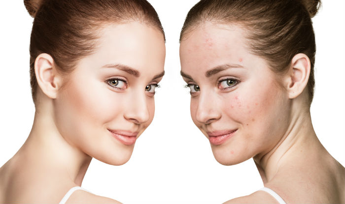 Enhances skin beauty