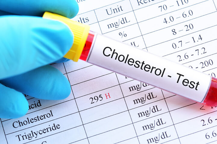 Lower cholesterol