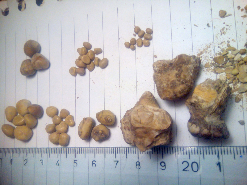 Photo on  Wikimedia Commons (https://commons.wikimedia.org/wiki/File:Kidney_stones_%28_renal_calculi_%29,_Бубрежни_камења_15.jpg)