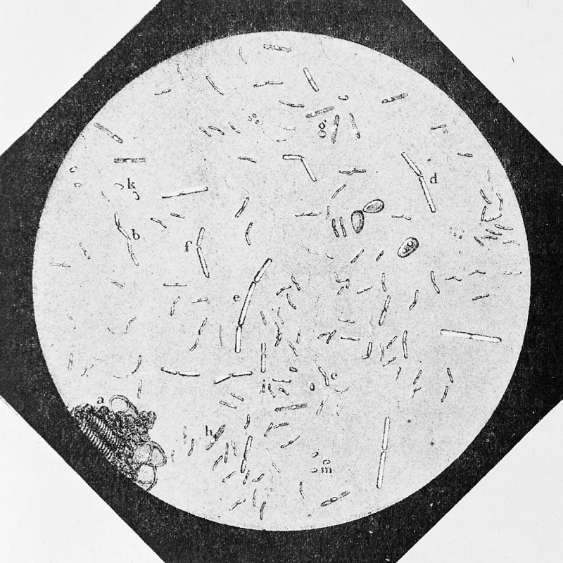 Silkworm disease -Photo: commons.wikimedia.org