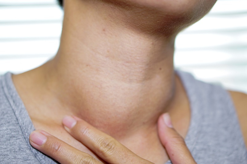 Manifestation of a swollen neck