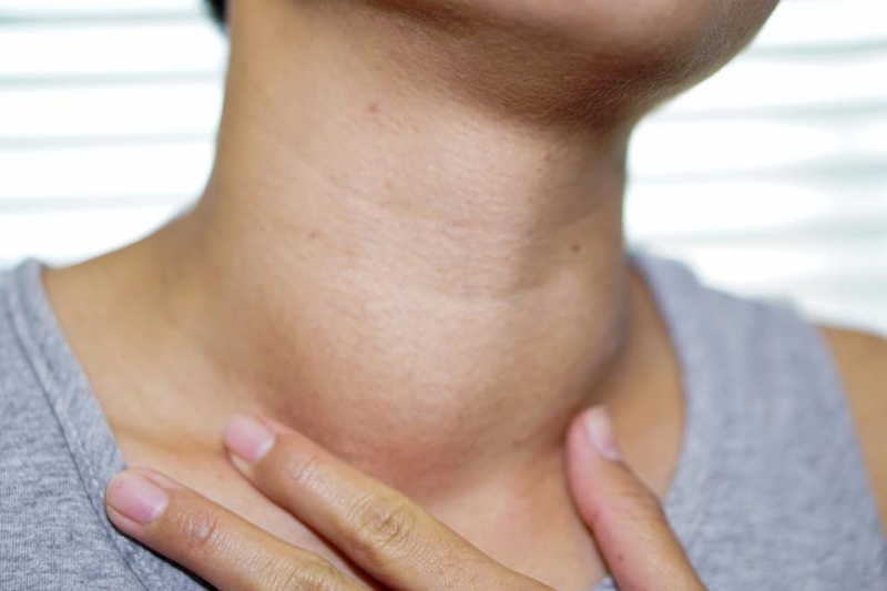 Overactive thyroid
