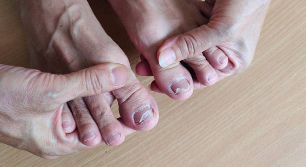 Swollen fingers or toes