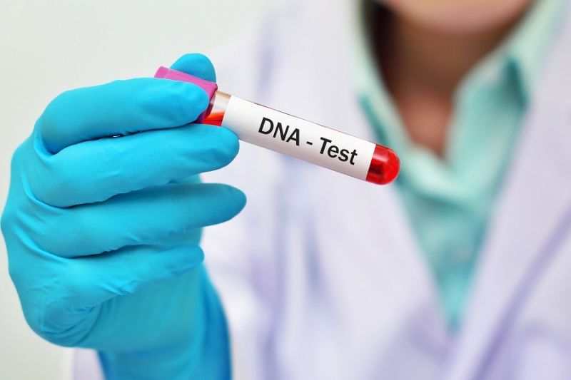 Take a DNA test