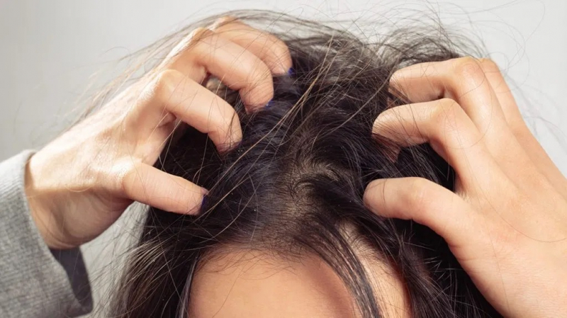 Treatment of scalp and hair problems