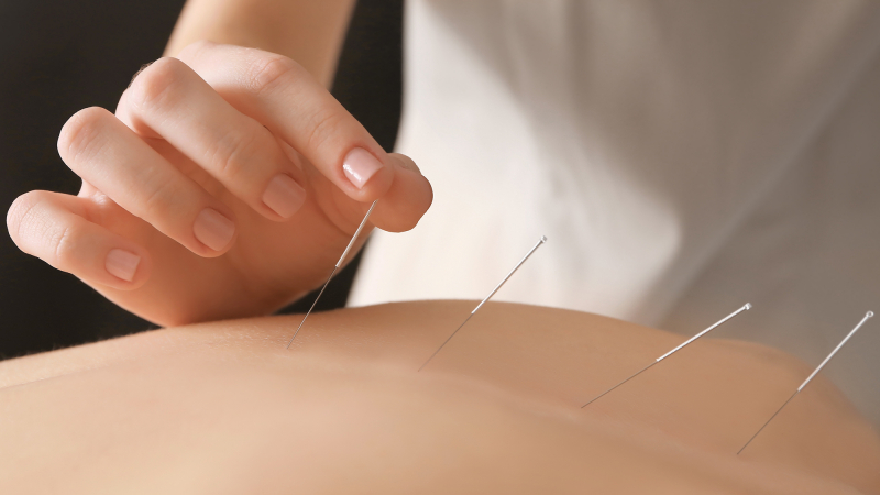 Try Acupuncture or Acupressure